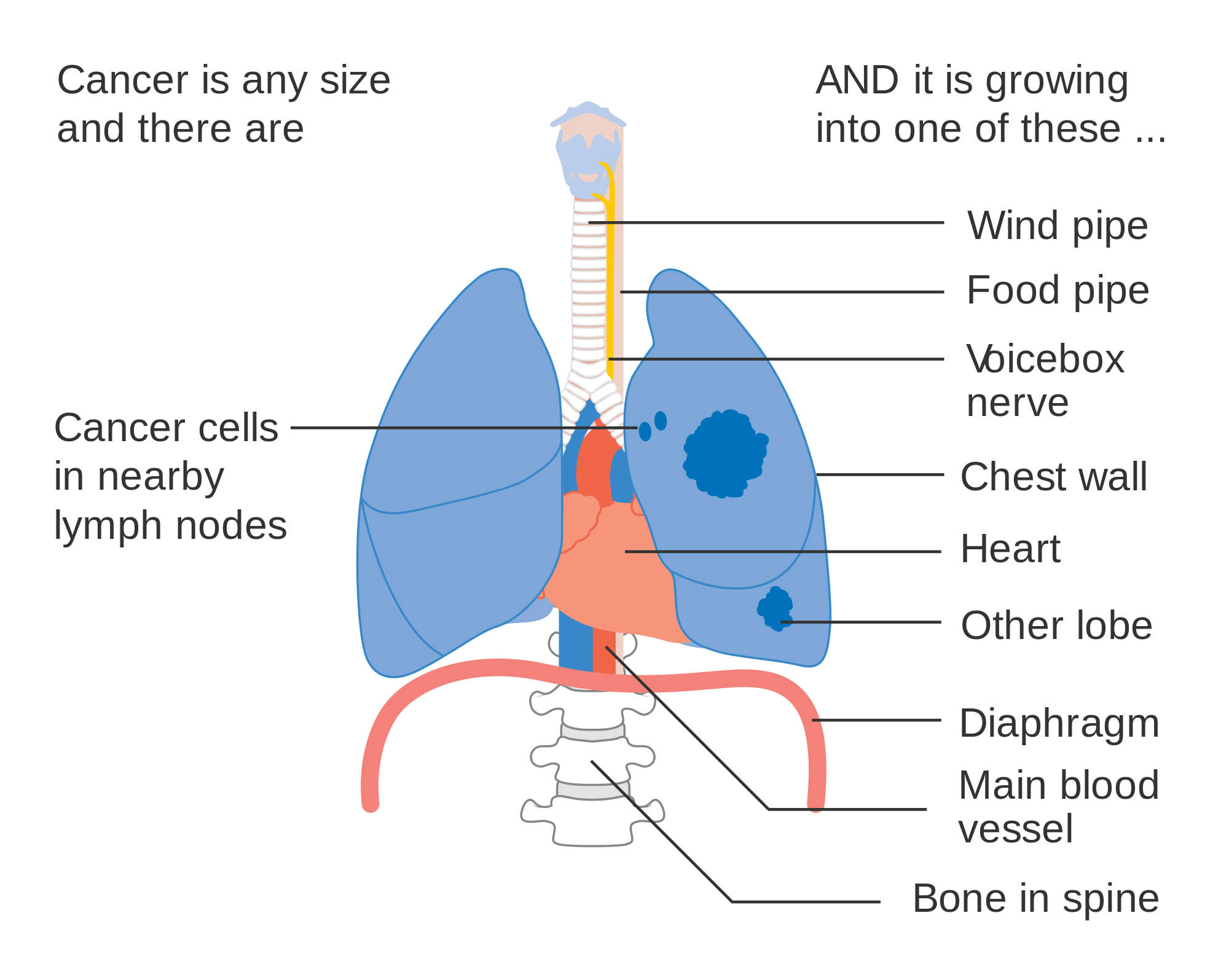 Three Quick Facts About Lung Cancer Treatments